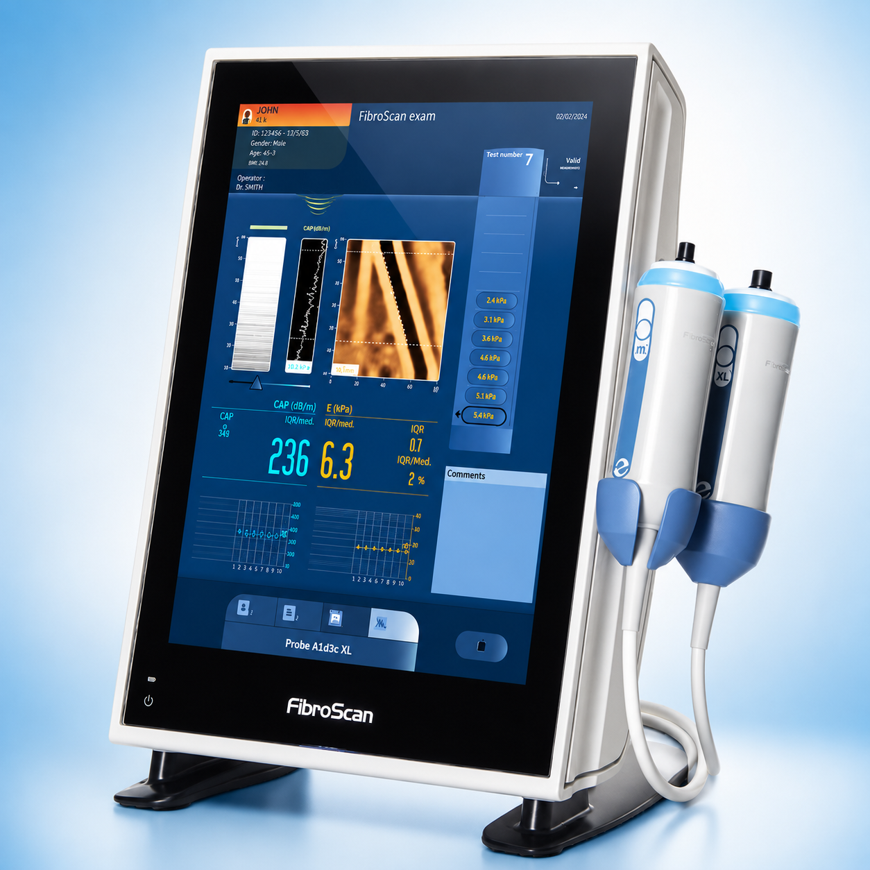 Equipo FibroScan para Elastografía Hepática